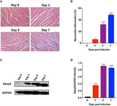 Dpep2 Emerging as a Modulator of Macrophage Inflammation Confers Protection Against CVB3-Induced Viral Myocarditis